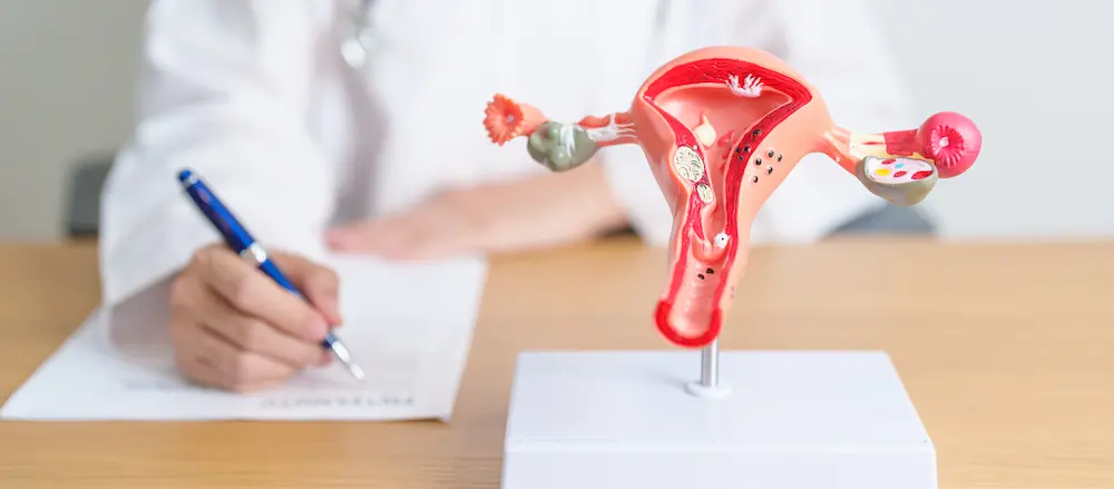 endometriosis doctor